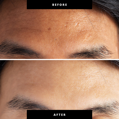 Rejuve Pro: 3-Minute New Age LED Pen